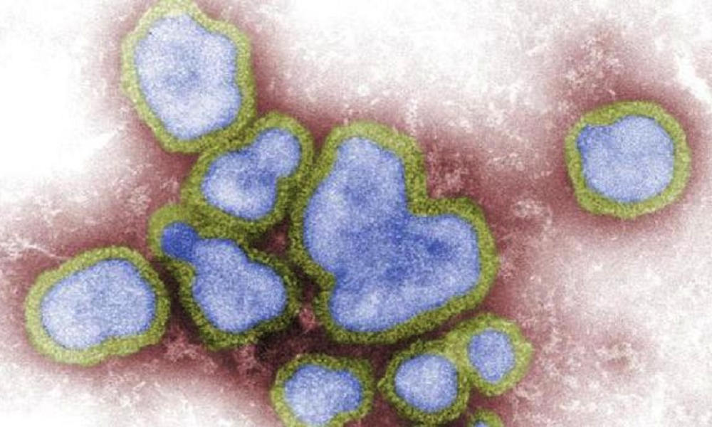 Chile reports human case of H5N1 bird flu