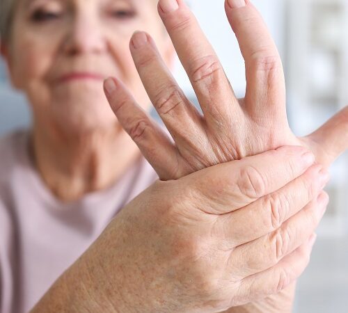 Women with rheumatoid arthritis more likely to achieve remission if they take sex hormones