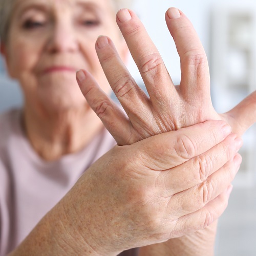 Women with rheumatoid arthritis more likely to achieve remission if they take sex hormones